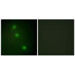 ATF1 Polyclonal Antibody