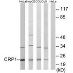 CRP1 Antibody in Western Blot (WB)