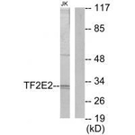 GTF2E2 Antibody in Western Blot (WB)