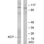 CMPK1 Polyclonal Antibody