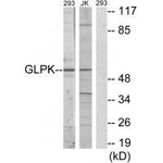 Glycerol kinase Antibody in Western Blot (WB)