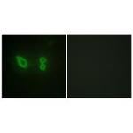 alpha Actinin 2/3 Polyclonal Antibody