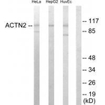 alpha Actinin 2/3 Antibody in Western Blot (WB)