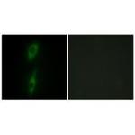 ACVRL1 Polyclonal Antibody