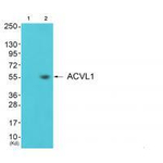 ACVRL1 Antibody in Western Blot (WB)