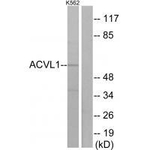 ACVRL1 Antibody in Western Blot (WB)