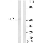FRK Antibody in Western Blot (WB)