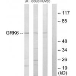 GRK6 Antibody in Western Blot (WB)