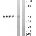 hnRNP F Polyclonal Antibody