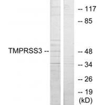 TMPRSS3 Antibody in Western Blot (WB)