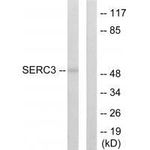 TDE1 Antibody in Western Blot (WB)