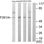 PFKFB1 Polyclonal Antibody