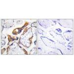 PHLDA2 Polyclonal Antibody