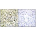CDKL4 Antibody in Immunohistochemistry (Paraffin) (IHC (P))
