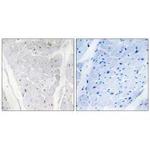 ALPK2 Polyclonal Antibody