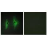 DGKH Polyclonal Antibody