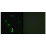 GLYCTK Polyclonal Antibody