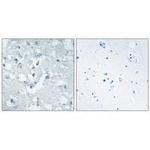 GLYCTK Antibody in Immunohistochemistry (Paraffin) (IHC (P))