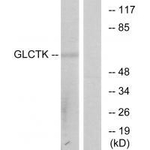 GLYCTK Antibody in Western Blot (WB)