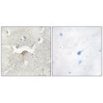 LMTK2 Antibody in Immunohistochemistry (Paraffin) (IHC (P))
