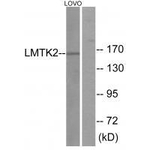 LMTK2 Antibody in Western Blot (WB)