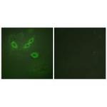 TUSC5 Polyclonal Antibody