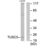 TUSC5 Antibody in Western Blot (WB)