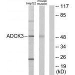 CABC1 Polyclonal Antibody