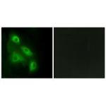 EPS8L3 Polyclonal Antibody