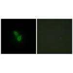 PARD3 Polyclonal Antibody