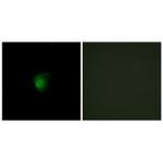 SMG7 Polyclonal Antibody