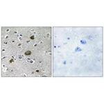 AKAP1 Antibody in Immunohistochemistry (Paraffin) (IHC (P))