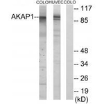 AKAP1 Antibody in Western Blot (WB)