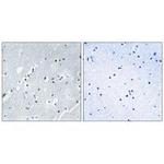 HIST1H2BH Antibody in Immunohistochemistry (Paraffin) (IHC (P))