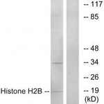 HIST1H2BH Antibody in Western Blot (WB)