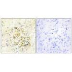 PMEPA1 Antibody in Immunohistochemistry (Paraffin) (IHC (P))