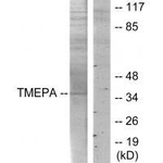 PMEPA1 Antibody in Western Blot (WB)