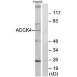 ADCK4 Antibody in Western Blot (WB)