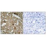 BTBD6 Polyclonal Antibody