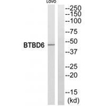 BTBD6 Antibody in Western Blot (WB)
