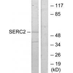 SERC2 Antibody in Western Blot (WB)