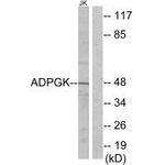 ADPGK Polyclonal Antibody