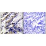 ILKAP Polyclonal Antibody