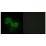 SLK Antibody in Immunocytochemistry (ICC/IF)