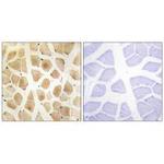 SLK Antibody in Immunohistochemistry (Paraffin) (IHC (P))
