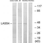 Lass4 Antibody in Western Blot (WB)