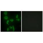 IARS2 Polyclonal Antibody