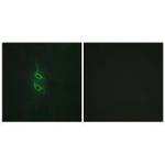 MRC2 Polyclonal Antibody