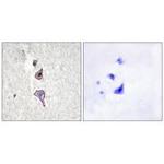 MRC2 Antibody in Immunohistochemistry (Paraffin) (IHC (P))