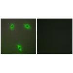 KLHL3 Polyclonal Antibody